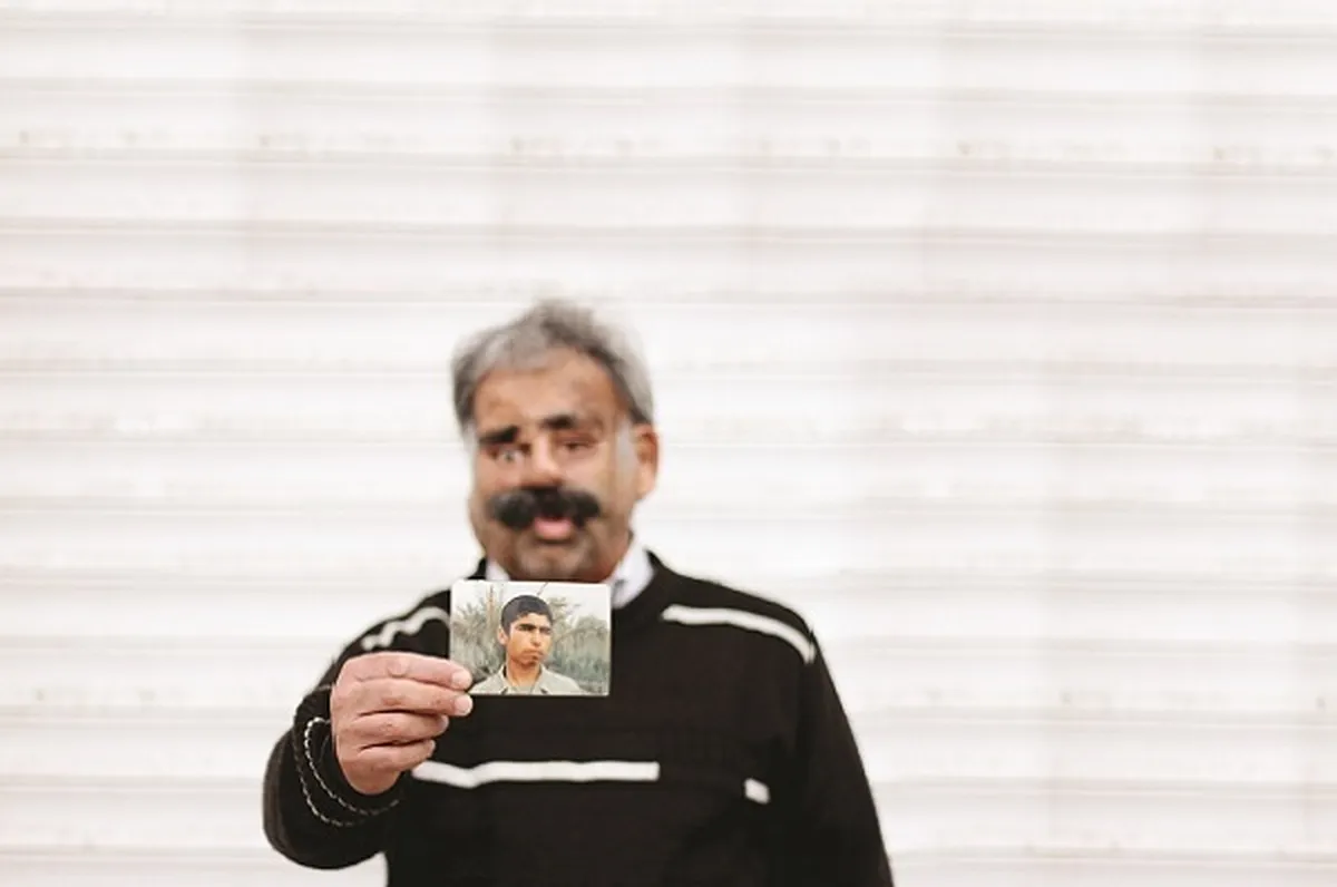 چهره حسن عمرانی صد بار زیر تیغ جراحی رفته است